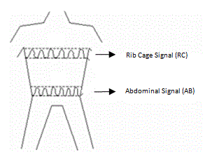 Respiratory inductance plethysmography